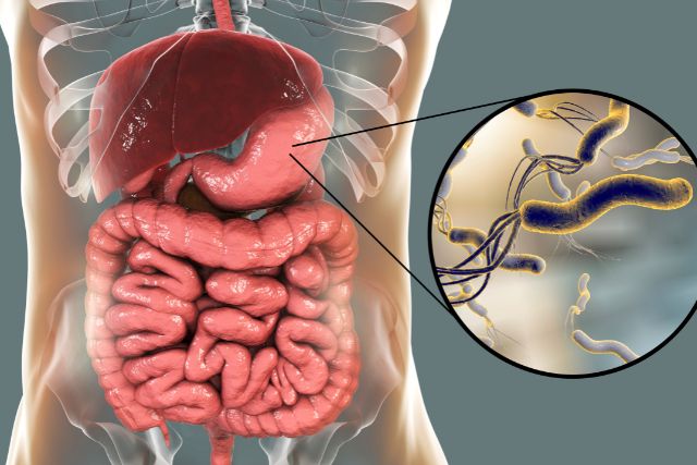 helicobacter pylori en el estómago