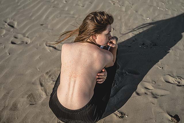 persona con léntigo