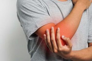 dolor por artritis reumatoide