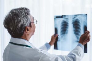médico consultando una radiografía de pulmón