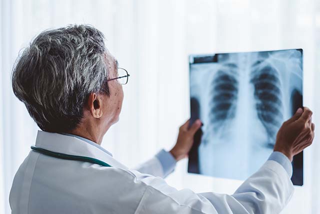 médico consultando una radiografía de pulmón